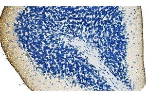 IHC analysis of Ankyrin Erythroid/ANK/ANK1 using anti-Ankyrin Erythroid/ANK/ANK1 antibody (ABIN7599959). (Erythrocyte Ankyrin Antikörper  (AA 1300-1844))