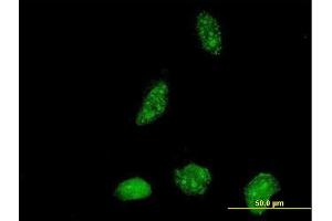 Immunofluorescence of purified MaxPab antibody to ICT1 on HeLa cell. (ICT1 Antikörper  (AA 1-206))