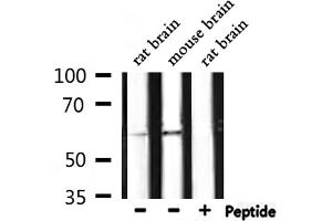 Western Blotting (WB) image for anti-Histone Deacetylase 3 (HDAC3) (pSer424) antibody (ABIN6256332)