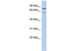 Image no. 1 for anti-Oxidative Stress Induced Growth Inhibitor 1 (OSGIN1) (AA 143-192) antibody (ABIN6743900) (OSGIN1 Antikörper  (AA 143-192))