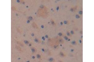 Immunohistochemistry (IHC) image for anti-ADAM Metallopeptidase with thrombospondin Type 1 Motif, 12 (ADAMTS12) (AA 827-1001) antibody (ABIN1857901)