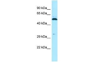 WB Suggested Anti-SPAM1 Antibody Titration: 1.