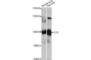 Western blot analysis of extracts of various cell lines, using C1S antibody. (C1S Antikörper)