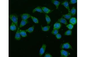 IF analysis of GLB1/Beta-galactosidase using anti-GLB1/Beta-galactosidase antibody (ABIN7601806). (GLB1 Antikörper  (AA 46-655))