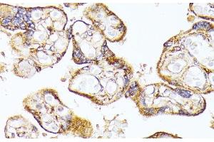 Immunohistochemistry of paraffin-embedded Human placenta using VEGF Receptor 1 Polyclonal Antibody at dilution of 1:100 (40x lens). (FLT1 Antikörper)