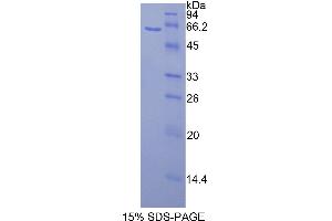 SDS-PAGE (SDS) image for Calbindin (CALB1) (AA 3-261) protein (His tag,GST tag) (ABIN1877659)
