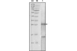 Western Blotting (WB) image for anti-Prostate Specific Antigen (PSA) (AA 26-251) antibody (ABIN2464094) (Prostate Specific Antigen Antikörper  (AA 26-251))