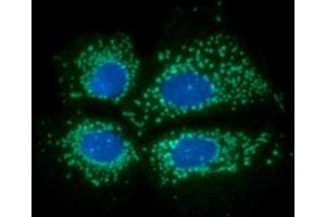 ICC/IF analysis of PDKZ1 in Hep3B cells line, stained with DAPI (Blue) for nucleus staining and monoclonal anti-human PDKZ1 antibody (1:100) with goat anti-mouse IgG-Alexa fluor 488 conjugate (Green). (PDZK1 Antikörper)