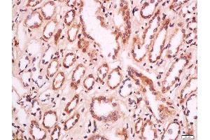 Formalin-fixed and paraffin embedded human kidney labeled with Anti-MELK/HPK38 Polyclonal Antibody, Unconjugated  at 1:200 followed by conjugation to the secondary antibody and DAB staining. (MELK Antikörper  (AA 101-250))