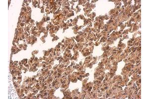 Immunohistochemistry (IHC) image for anti-Transmembrane Protein 59 (TMEM59) antibody (ABIN2855840)