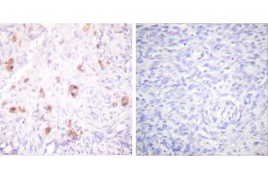 P-peptide - +Immunohistochemical analysis of paraffin-embedded human ovary tissue using IKK-γ (Phospho-Ser31) Antibody (#A0443). (IKBKG Antikörper  (pSer31))