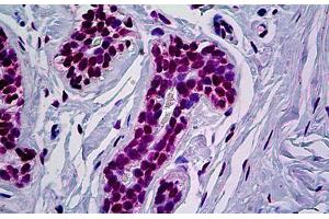 Human Breast: Formalin-Fixed, Paraffin-Embedded (FFPE) (RUNX1 Antikörper  (AA 210-311))