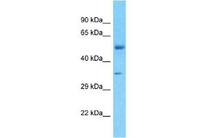Host:  Rabbit  Target Name:  FBXO2  Sample Tissue:  Human Liver Tumor  Antibody Dilution:  1ug/ml (FBXO2 Antikörper  (Middle Region))