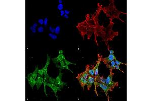 Immunocytochemistry/Immunofluorescence analysis using Mouse Anti-Piccolo Monoclonal Antibody, Clone 6H9-B6 (ABIN863104 and ABIN863105). (Piccolo Antikörper)