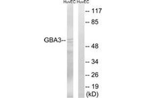 Western blot analysis of extracts from HuvEc cells, using GBA3 Antibody.