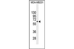 Western blot analysis of HNF1 beta / TCF2 Antibody (C-term) in MDA-MB231 cell line lysates (35ug/lane). (HNF1B Antikörper  (C-Term))