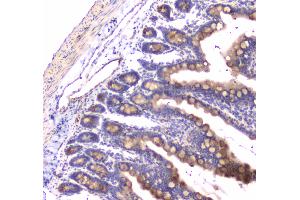 Immunohistochemistry (IHC) image for anti-RAB27A, Member RAS Oncogene Family (RAB27A) (AA 98-216) antibody (ABIN5692927)