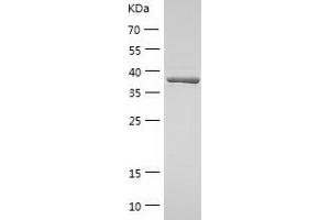 Western Blotting (WB) image for Cysteine-Rich, Angiogenic Inducer, 61 (CYR61) (AA 25-381) protein (His tag) (ABIN7122563)