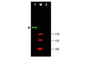 Image no. 1 for anti-GLI Family Zinc Finger 2 (GLI2) (Internal Region) antibody (ABIN401282) (GLI2 Antikörper  (Internal Region))