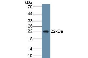 Detection of Recombinant PGD2S, Human using Monoclonal Antibody to Prostaglandin-H2 D-isomerase (PTGDS) (PTGDS Antikörper  (AA 32-190))