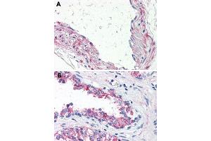 Immunohistochemical staining of formalin-fixed, paraffin-embedded human vessel (A) and human prostate (B) tissue after heat-induced antigen retrieval. (5HT1B Receptor Antikörper  (Internal Region))