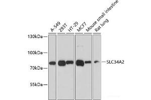 Western blot analysis of extracts of various cell lines using SLC34A2 Polyclonal Antibody at dilution of 1:3000. (SLC34A2 Antikörper)