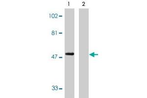 Western blot analysis using CX3CR1 polyclonal antibody at 1 ug/mL on human spleen lysate in the absence (lane 1) and presence (lane 2) of specific blocking peptide. (CX3CR1 Antikörper  (AA 2-21))