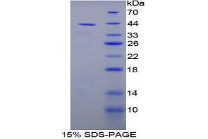 SDS-PAGE (SDS) image for Natriuretic Peptide Type C (NPPC) (AA 31-126) protein (His tag,GST tag) (ABIN1879841)