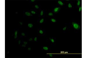 Immunofluorescence of monoclonal antibody to EP300 on HeLa cell. (p300 Antikörper  (AA 731-830))