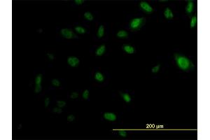 Immunofluorescence of monoclonal antibody to EP300 on HeLa cell. (p300 Antikörper  (AA 731-830))