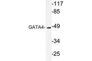 Western blot analysis of GATA4 antibody in extracts from COLO205 cells. (GATA4 Antikörper)