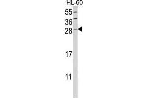 Western blot analysis of GZMB Antibody (C-term) in HL-60 cell line lysates (35 µg/lane). (GZMB Antikörper  (C-Term))