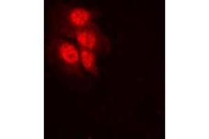 Immunofluorescent analysis of MKK1 (pT292) staining in HeLa cells. (MEK1 Antikörper  (pSer292))