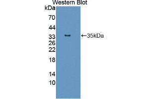 Western blot analysis of the recombinant protein. (TPM3 Antikörper  (AA 6-248))
