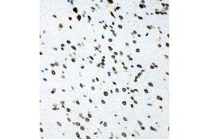 Anti-SHC antibody, IHC(F) IHC(F): Rat Brain Tissue (SHC1 Antikörper  (C-Term))