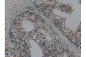 Immunohistochemistry (IHC) image for anti-Lymphotoxin beta Receptor (TNFR Superfamily, Member 3) (LTBR) (AA 66-215) antibody (ABIN7437122)