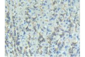 Immunohistochemistry (Paraffin-embedded Sections) (IHC (p)) image for anti-Cadherin 1, Type 1, E-Cadherin (Epithelial) (CDH1) (AA 155-266) antibody (ABIN2901804)