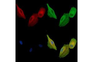 ABIN7095037 and ABIN7099093 staining  cells by IF/ICC. (CCDC39 Antikörper)