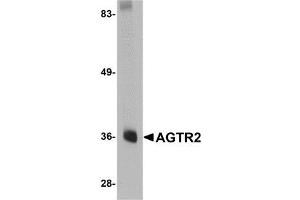 Western blot analysis of AGTR2 in mouse liver tissue lysate with AP30027PU-N AGTR2 antibody at 0. (Angiotensin II Type 2 Receptor Antikörper  (Center))