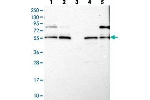 Western blot analysis of Lane 1: RT-4, Lane 2: U-251 MG, Lane 3: Human Plasma, Lane 4: Liver, Lane 5: Tonsil with LRCH4 polyclonal antibody .