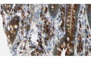 ABIN6275968 at 1/100 staining Mouse intestine tissue by IHC-P. (Adenosine A2a Receptor Antikörper  (Internal Region))