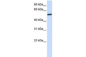 WB Suggested Anti-ALAS2 Antibody Titration:  0. (ALAS2 Antikörper  (C-Term))