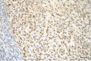 anti-Caspase 3 p12 antibody