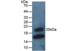 Detection of GREM1 in Rat Intestine Tissue using Polyclonal Antibody to Gremlin 1 (GREM1) (GREM1 Antikörper  (AA 26-184))