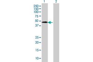 Lane 1: SETMAR transfected lysate ( 38. (SETMAR 293T Cell Transient Overexpression Lysate(Denatured))
