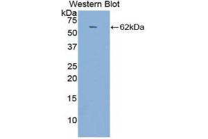 Western Blotting (WB) image for anti-Angiotensin I Converting Enzyme (Peptidyl-Dipeptidase A) 1 (ACE) (AA 814-1071) antibody (ABIN1857858) (Angiotensin I Converting Enzyme 1 Antikörper  (AA 814-1071))