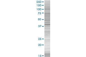 Western Blotting (WB) image for PARK2 293T Cell Transient Overexpression Lysate(Denatured) (ABIN1332870)