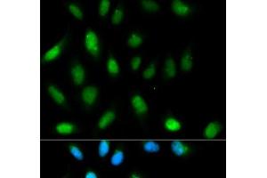 Immunofluorescence analysis of HeLa cells using CBX5 Polyclonal Antibody (CBX5 Antikörper)