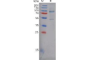 SDS-PAGE (SDS) image for P-Cadherin (CDH3) (AA 18-654) protein (His tag) (ABIN6964122)