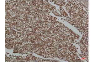 Immunohistochemistry (IHC) analysis of paraffin-embedded Human Liver Tissue using Smad3 Mouse Monoclonal Antibody diluted at 1:200. (SMAD3 Antikörper)